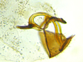 Coniopteryx esbenpeterseni genitalia